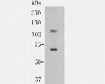 ACE2 Antibody in Western Blot (WB)