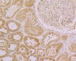 CLIC4 Antibody in Immunohistochemistry (Paraffin) (IHC (P))