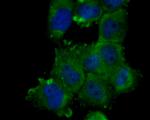 Nhe-1 Antibody in Immunocytochemistry (ICC/IF)