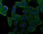 Nhe-1 Antibody in Immunocytochemistry (ICC/IF)