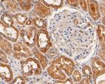 Nhe-1 Antibody in Immunohistochemistry (Paraffin) (IHC (P))