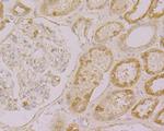 Drebrin Antibody in Immunohistochemistry (Paraffin) (IHC (P))