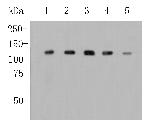 Drebrin Antibody in Western Blot (WB)