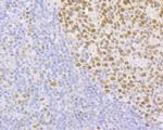 FEN1 Antibody in Immunohistochemistry (Paraffin) (IHC (P))