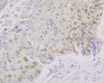 FEN1 Antibody in Immunohistochemistry (Paraffin) (IHC (P))