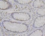 FEN1 Antibody in Immunohistochemistry (Paraffin) (IHC (P))