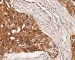 KIDINS220 Antibody in Immunohistochemistry (Paraffin) (IHC (P))