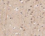 KIDINS220 Antibody in Immunohistochemistry (Paraffin) (IHC (P))