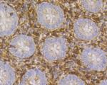 Thymidine Phosphorylase Antibody in Immunohistochemistry (Paraffin) (IHC (P))