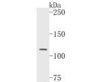 Rab11 FIB3 Antibody in Western Blot (WB)