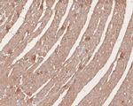 TRPM4 Antibody in Immunohistochemistry (Paraffin) (IHC (P))