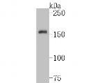 TRPM4 Antibody in Western Blot (WB)