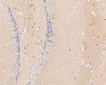 GABRA5 Antibody in Immunohistochemistry (Paraffin) (IHC (P))