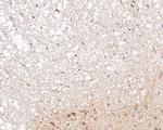 P2X3 Antibody in Immunohistochemistry (Paraffin) (IHC (P))