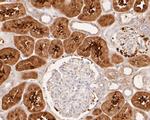 Aldolase B Antibody in Immunohistochemistry (Paraffin) (IHC (P))