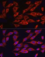 ATF6 Antibody in Immunocytochemistry (ICC/IF)