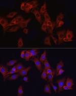 ATF6 Antibody in Immunocytochemistry (ICC/IF)