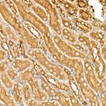 ATF6 Antibody in Immunohistochemistry (Paraffin) (IHC (P))