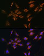 FGF2 Antibody in Immunocytochemistry (ICC/IF)