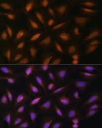 FGF2 Antibody in Immunocytochemistry (ICC/IF)