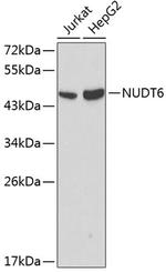 NUDT6 Antibody in Western Blot (WB)