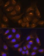 Caspase 9 Antibody in Immunocytochemistry (ICC/IF)