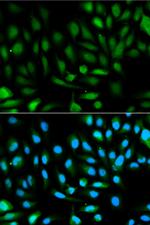 DJ-1 Antibody in Immunocytochemistry (ICC/IF)