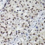 CCNK Antibody in Immunohistochemistry (Paraffin) (IHC (P))