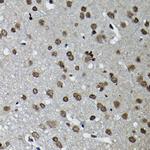 CCNK Antibody in Immunohistochemistry (Paraffin) (IHC (P))