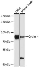 CCNK Antibody in Western Blot (WB)