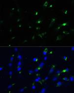 ENO1 Antibody in Immunocytochemistry (ICC/IF)