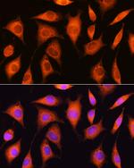 RRP4 Antibody in Immunocytochemistry (ICC/IF)