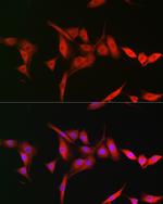 TRIM31 Antibody in Immunocytochemistry (ICC/IF)