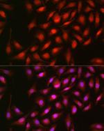 ERK2 Antibody in Immunocytochemistry (ICC/IF)