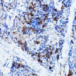 ERK2 Antibody in Immunohistochemistry (Paraffin) (IHC (P))