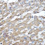 ERK2 Antibody in Immunohistochemistry (Paraffin) (IHC (P))