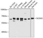 GlyT2 Antibody in Western Blot (WB)