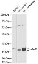 GAS2 Antibody in Western Blot (WB)