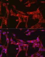 Bax Antibody in Immunocytochemistry (ICC/IF)