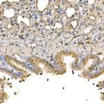 Bax Antibody in Immunohistochemistry (Paraffin) (IHC (P))