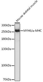 MYH6 Antibody in Western Blot (WB)