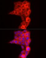 TDO2 Antibody in Immunocytochemistry (ICC/IF)