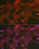 SOD2 (MnSOD) Antibody in Immunocytochemistry (ICC/IF)