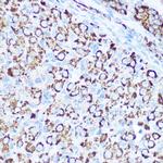 SOD2 (MnSOD) Antibody in Immunohistochemistry (Paraffin) (IHC (P))