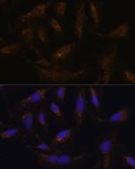 UCP4 Antibody in Immunocytochemistry (ICC/IF)