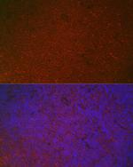 FCGR2A Antibody in Immunohistochemistry (Paraffin) (IHC (P))