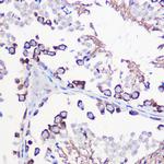 DAZL Antibody in Immunohistochemistry (Paraffin) (IHC (P))