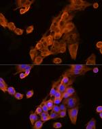 ApoC3 Antibody in Immunocytochemistry (ICC/IF)