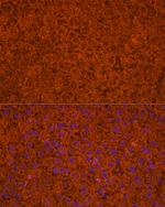 ApoC3 Antibody in Immunocytochemistry (ICC/IF)