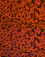 ApoC3 Antibody in Immunocytochemistry (ICC/IF)